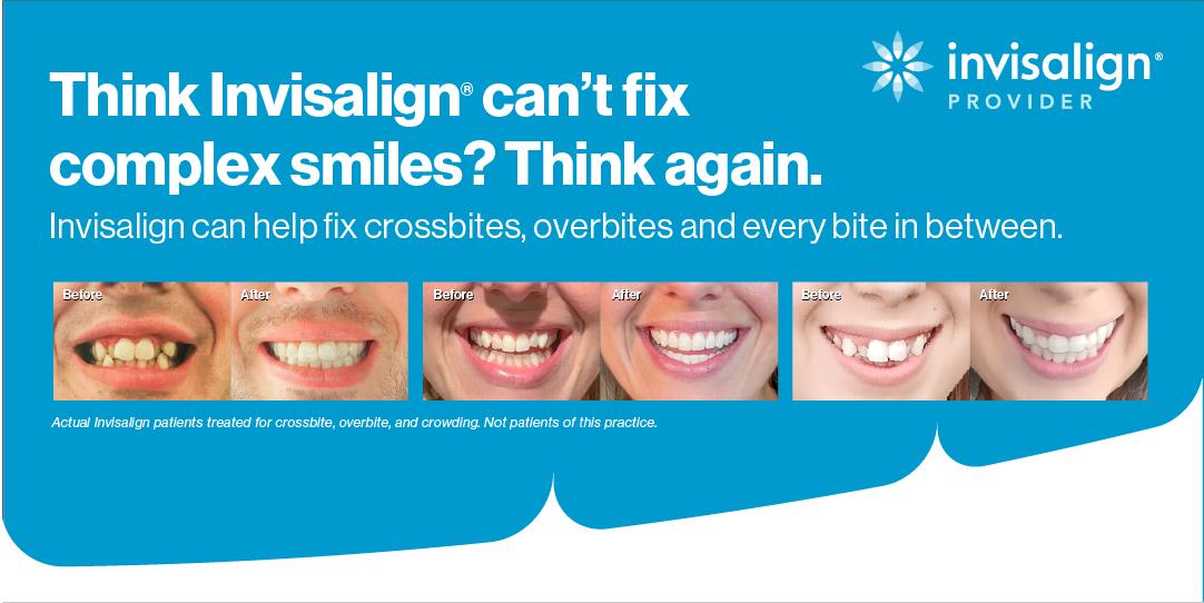 A straight, healthy smile showing the benefits of orthodontic treatment at Soquel Dental Office in Soquel, CA